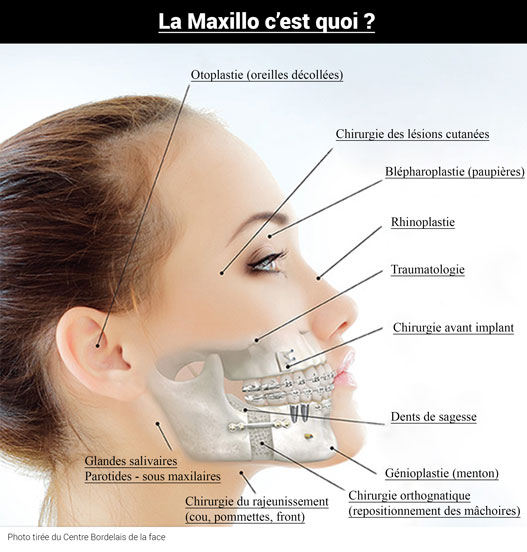 Docteur Nicolas VIDAL. La maxillo c'est quoi ?