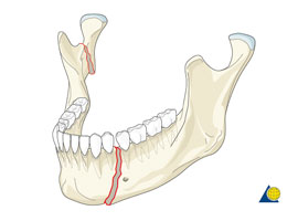 Docteur Nicolas VIDAL. Chirurgie maxillofaciale et esthétique du visage à la Réunion 974. Rhinoplastie. Orthognatique. Stomatologie. Otoplastie. Blépharoplastie.